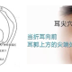 神奇的耳尖放血能治挺多种病