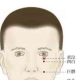 足阳明腧穴●承泣（别名:鼷穴、面髎、谿穴;阳跷脉、任脉、足阳明胃经交会穴） ... ...