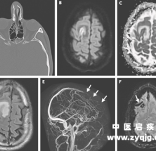 1 米 9 小伙门诊抽搐 4 次，主任束手无策，原因竟藏在 20 年前