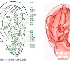 神奇的中医外治疗法之耳穴压丸