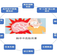 “卒”不及防，“脑”动乾坤