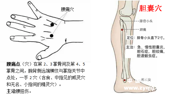 腰痛点（威灵穴、精灵穴） 胆囊穴位置功用.png