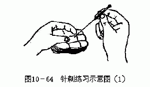 第四章 刺灸法·毫针刺法