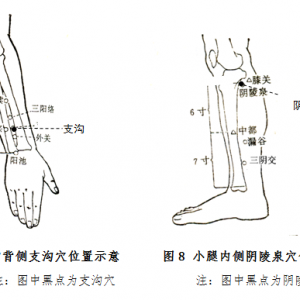 老年人体质之湿热质的中医药保健方法