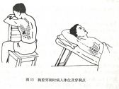 常用急救诊疗技术●穿刺术●胸膜腔穿刺术