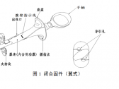 一次性使用微创筋膜闭合器注册审查指导原则（国家药监局通告2021年 第102号） ... ... ...