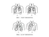 内伤·胸部内伤·气胸