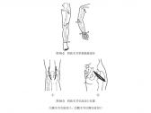骨病·化脓性关节炎