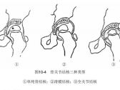 骨病·骨关节结核