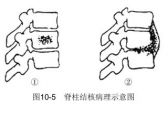 骨病·骨关节结核·脊柱结核