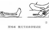 骨病·骨关节结核·髋关节结核