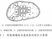 原发性肝癌诊疗指南（2022年版）（国卫办医函〔2022〕12号）全文 ... ... ... ... ... ...