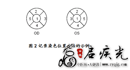接触镜护理产品注册技术审查指导原则(食药监办械函〔2011〕116号) ... ... ... ...