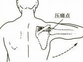 四肢关节病证推拿●四肢关节病证●冈上肌肌腱炎