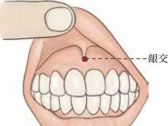督脉腧穴●龈交(别名:齿龈筋中)