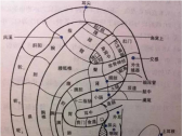 耳穴压豆