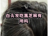 脱发白发，吃黑芝麻就能管用吗？您可能误会了