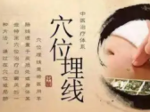 穴位埋线老技法  享“瘦”轻松新生活