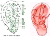 神奇的中医外治疗法之耳穴压丸